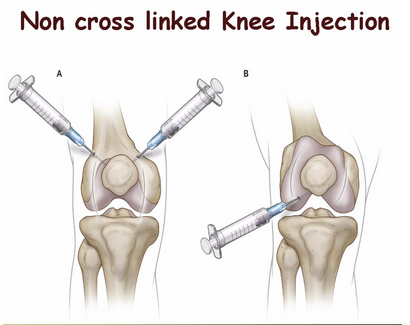 Intra articular joint injection guidelines